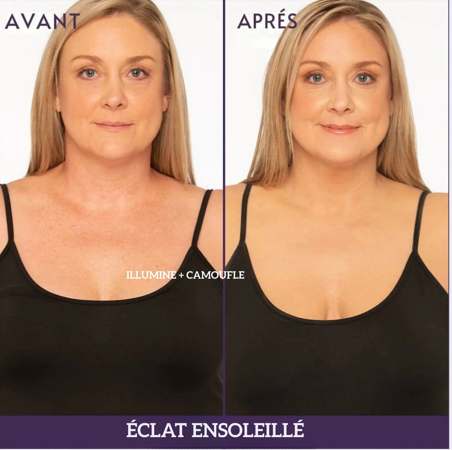 Lunisse™️ Votre crème qui couvre vos problèmes de peau